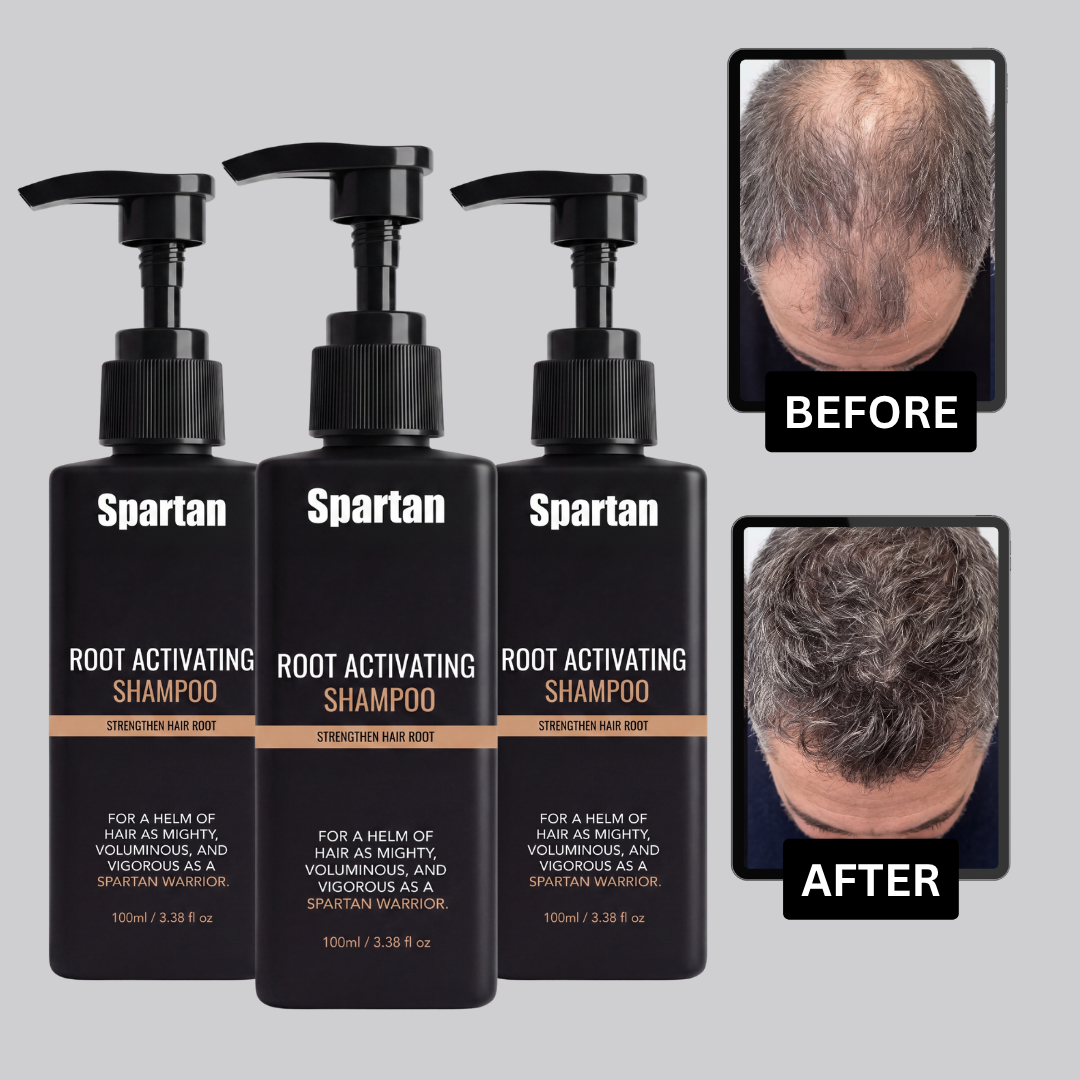 Spartan Root Activator Shampoo