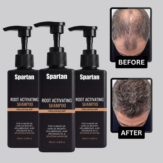 Spartan Root Activator Shampoo