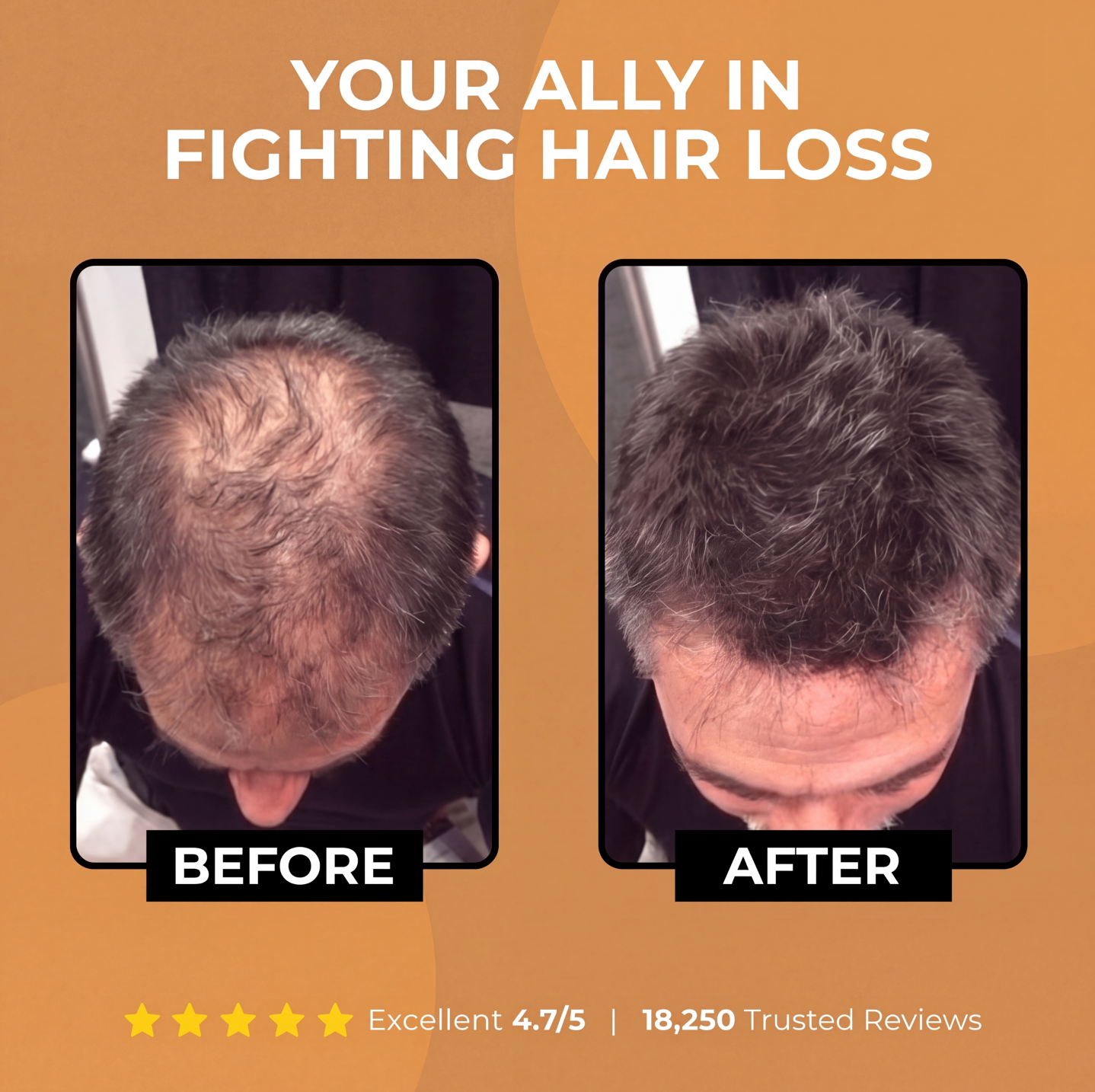 Spartan Root Activator Shampoo