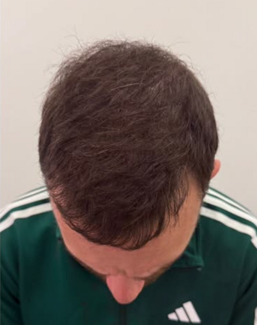 After